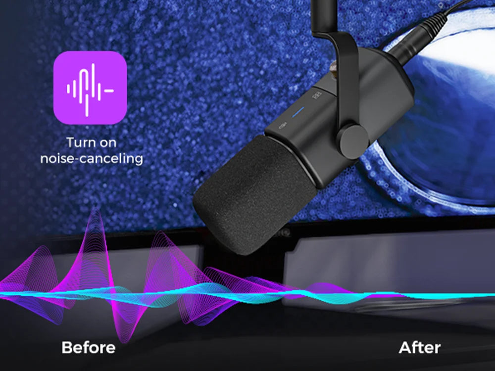 NearStream Professional Microphone Dynamic XLR USB Mic Desktop US Local Shipping Plug-and-Play for Gaming Studio Streaming